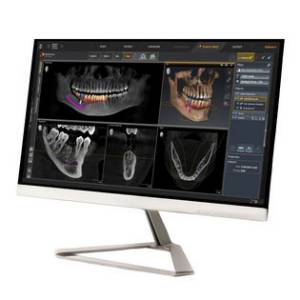Dentsply Sirona SICAT