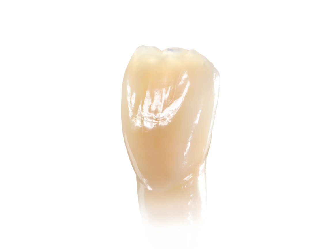 Ivoclar SR Nexco Paste