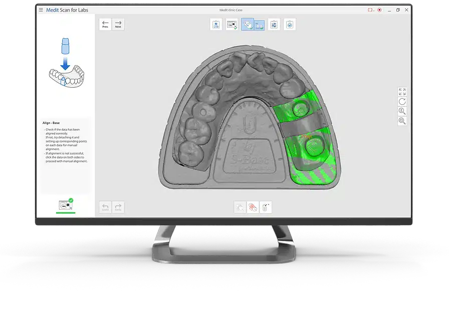 Medit Medit Scan for Labs3D dental solution for labs