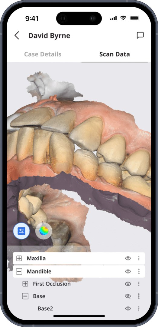 Medit MEDIT MDigital dentistry in your pocket