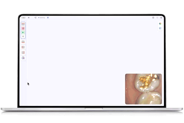 Medit Medit Link ExpressSimple, intuitive scanning workflow