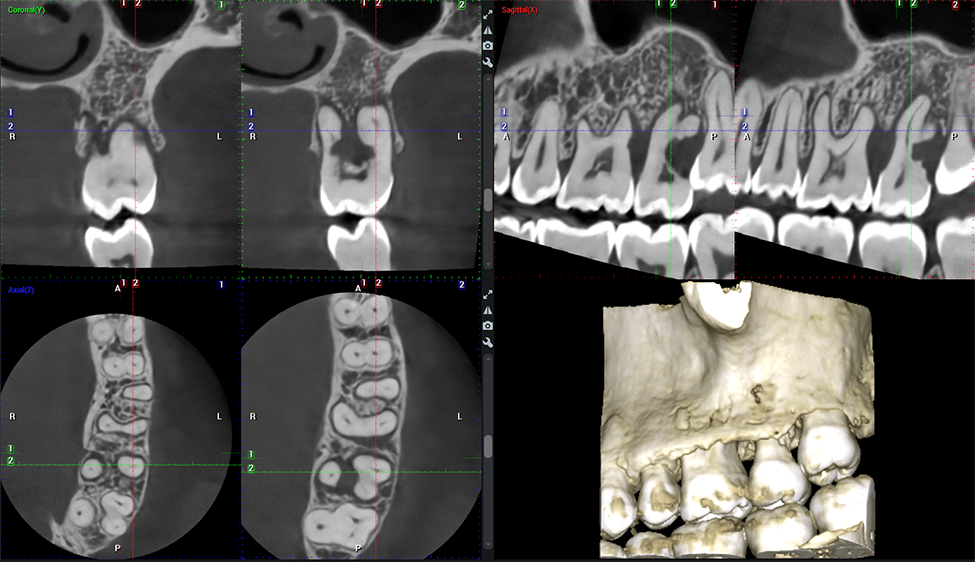 Planmeca Clinical images