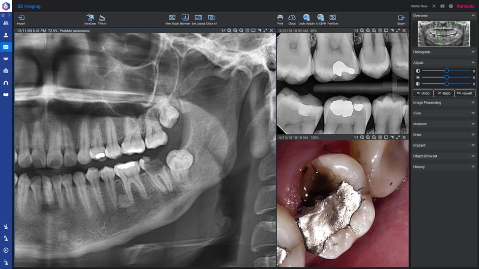 Planmeca Romexis 2D imaging