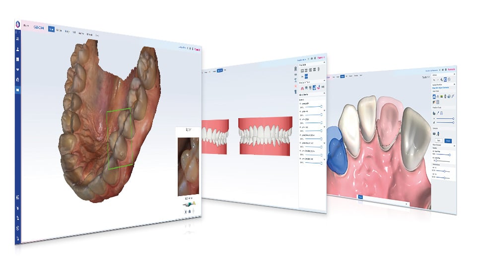 Planmeca Romexis CAD/CAM