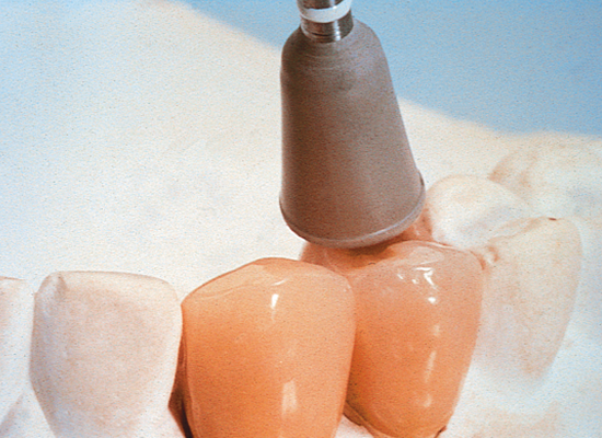 Shofu Ceramisté® & Ceramisté® Soft